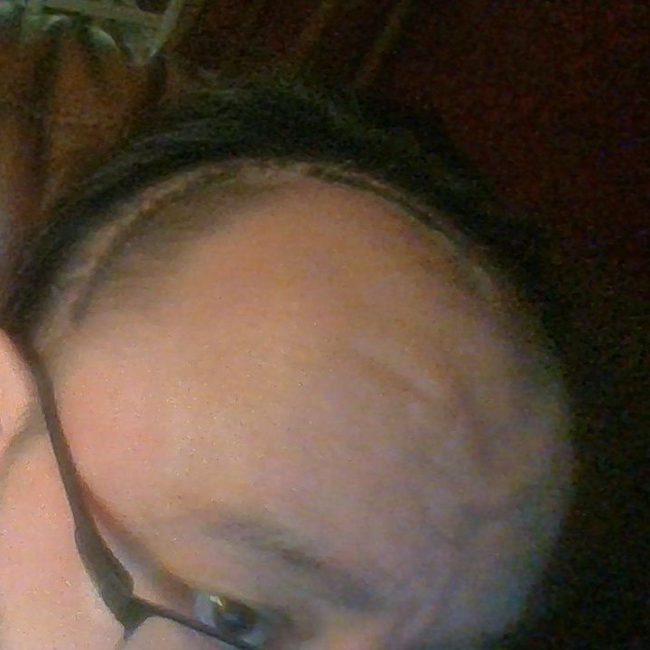 scarhead.jpg.6b936b1ed37a5d59f765d789c9e6f290.jpg
